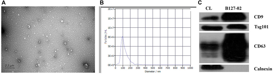 Characterization of hMSC exosomes by TEM imaging, nanoparticle tracking analysis, and Western blot of surface markers.